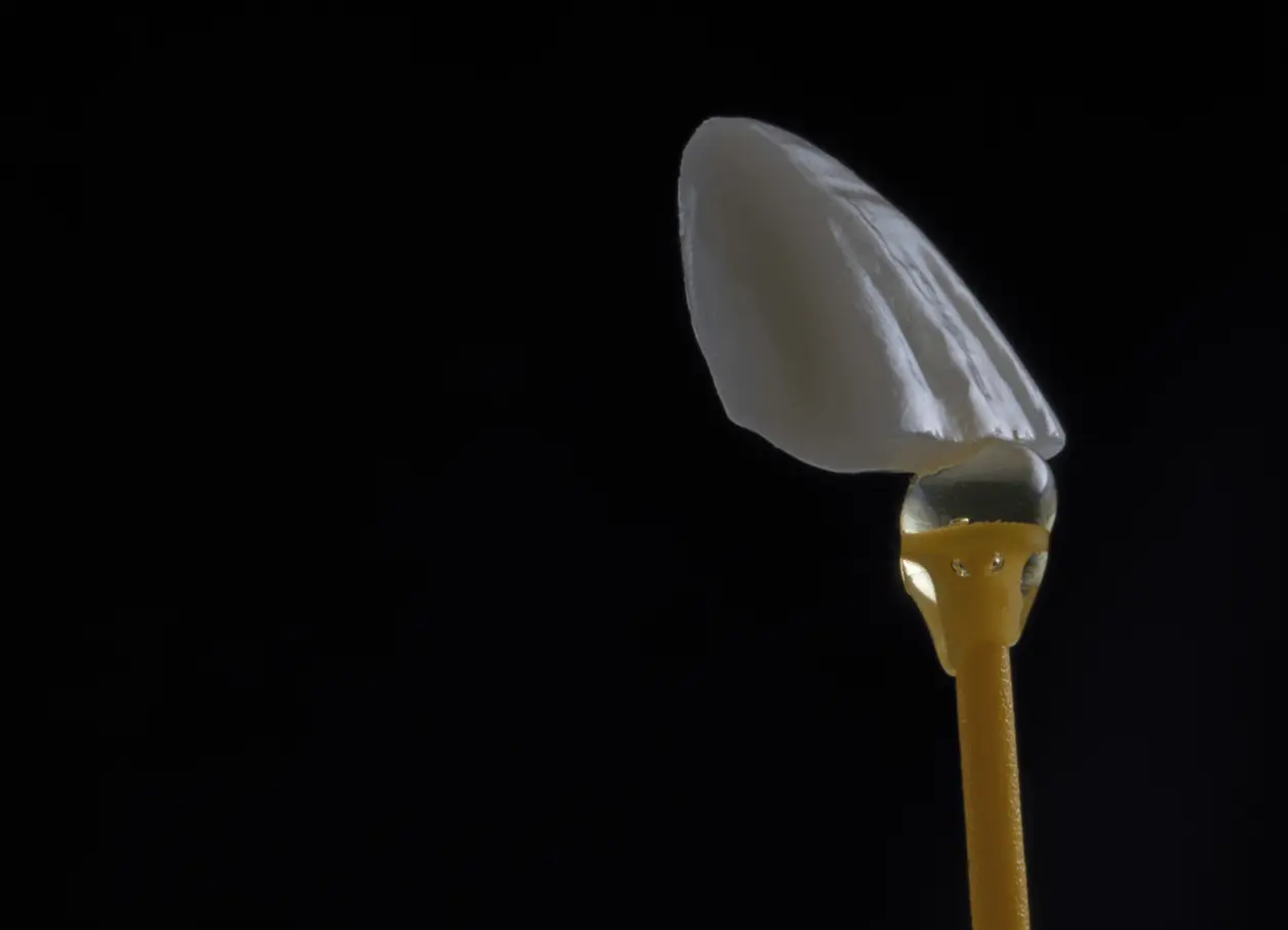 Carillas Dentales Ceramica